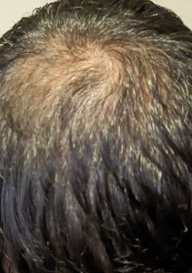 Before - Steven