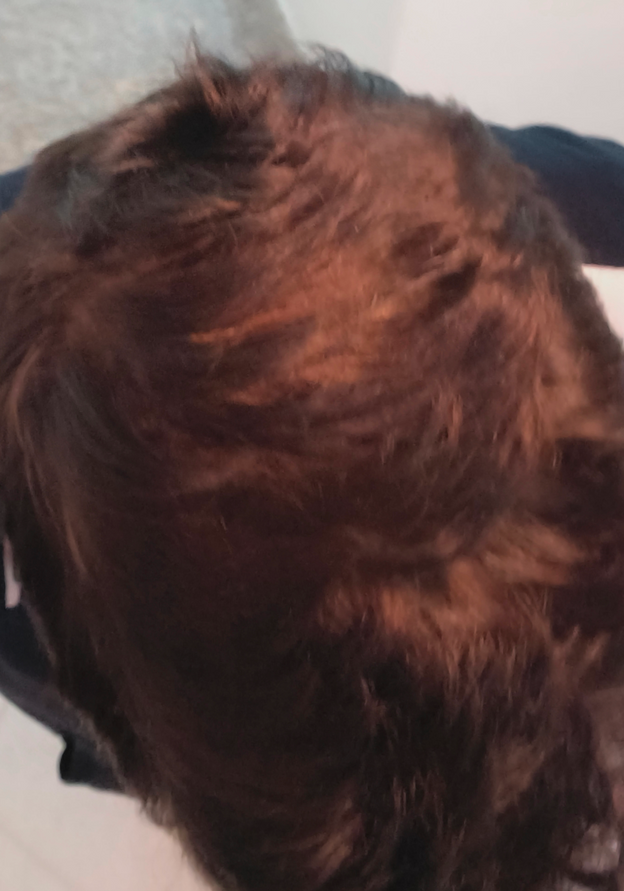 Before - Davide