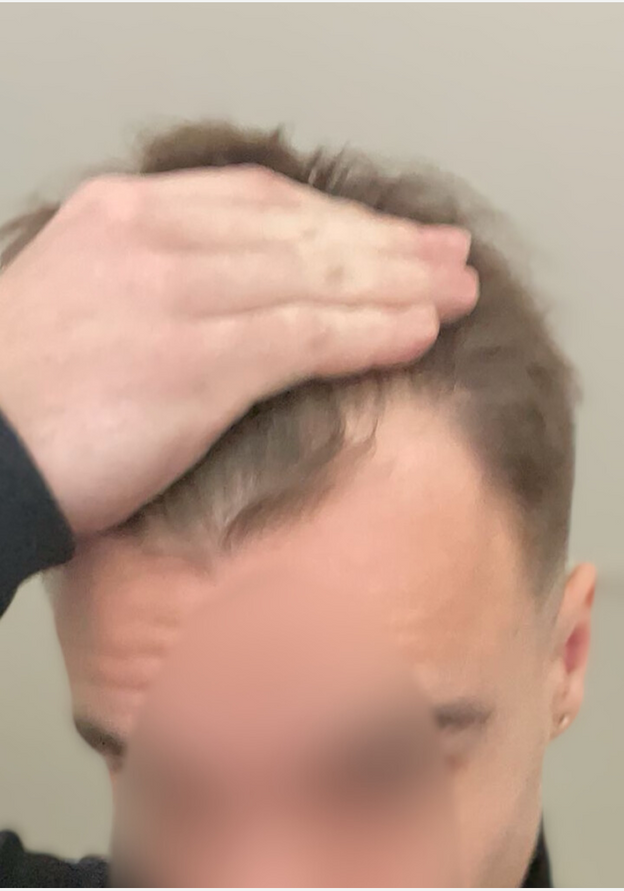 Before - Donatas