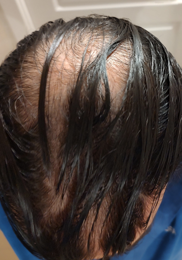 Before - Fabio