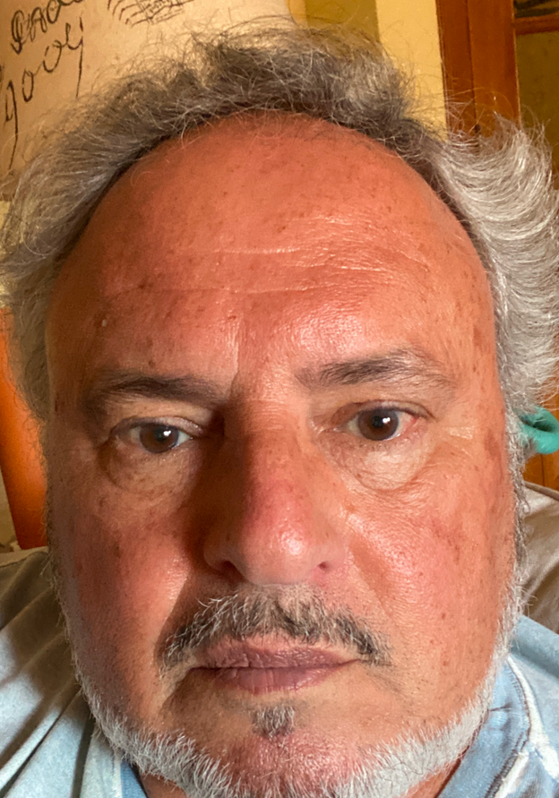 Before - Fernando
