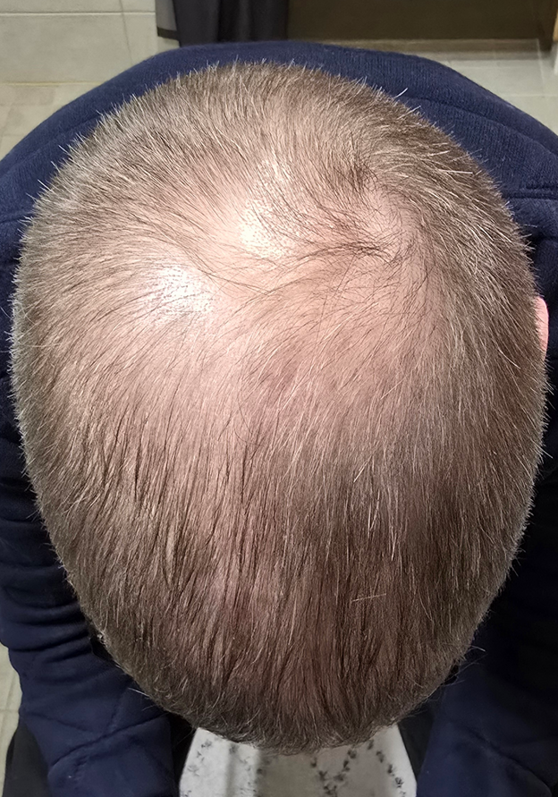 Before - Ivo