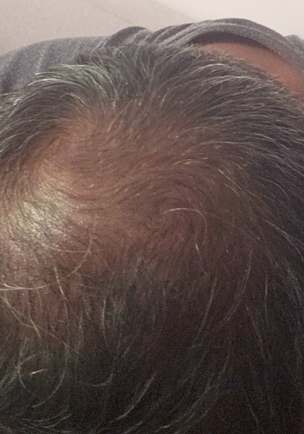 Before - Karthick