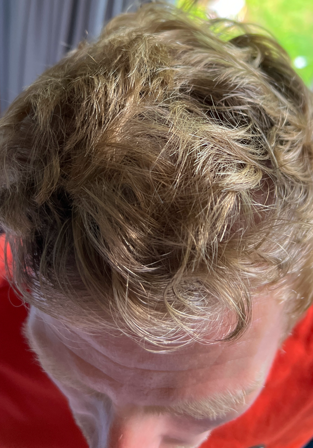 After - Richard