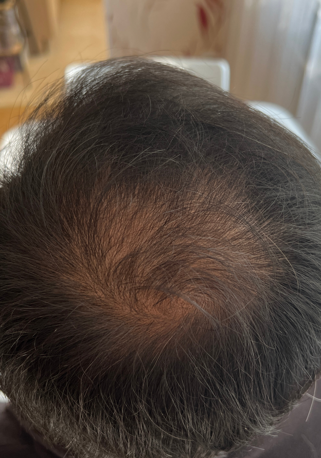 After - Shajahan