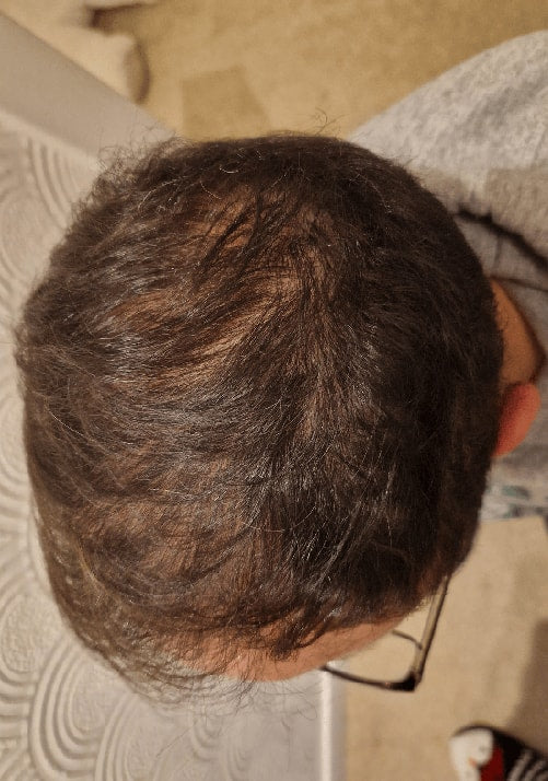 After - Mourad