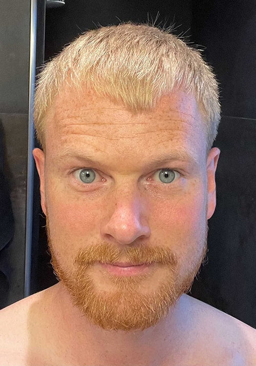 After - Niels