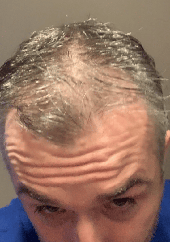 Before - Paul