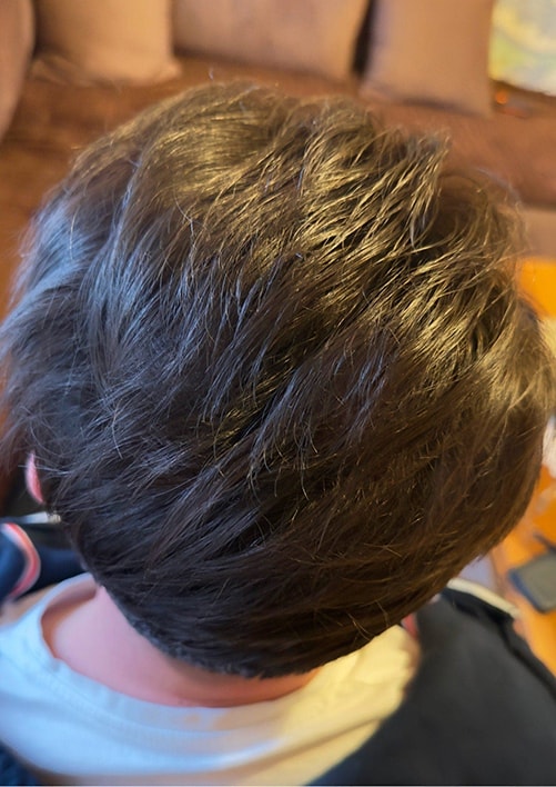 After