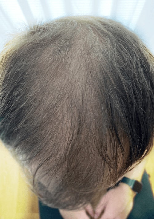 Before - Michel