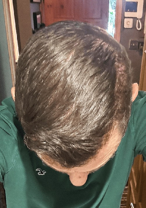 After - Rick