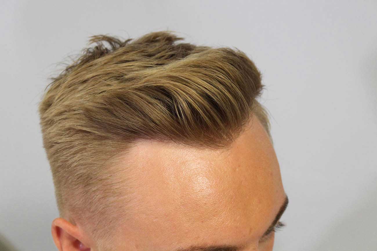 9 Hairline Types: Find Your Shape and Best Styles – Scandinavianbiolabs ...