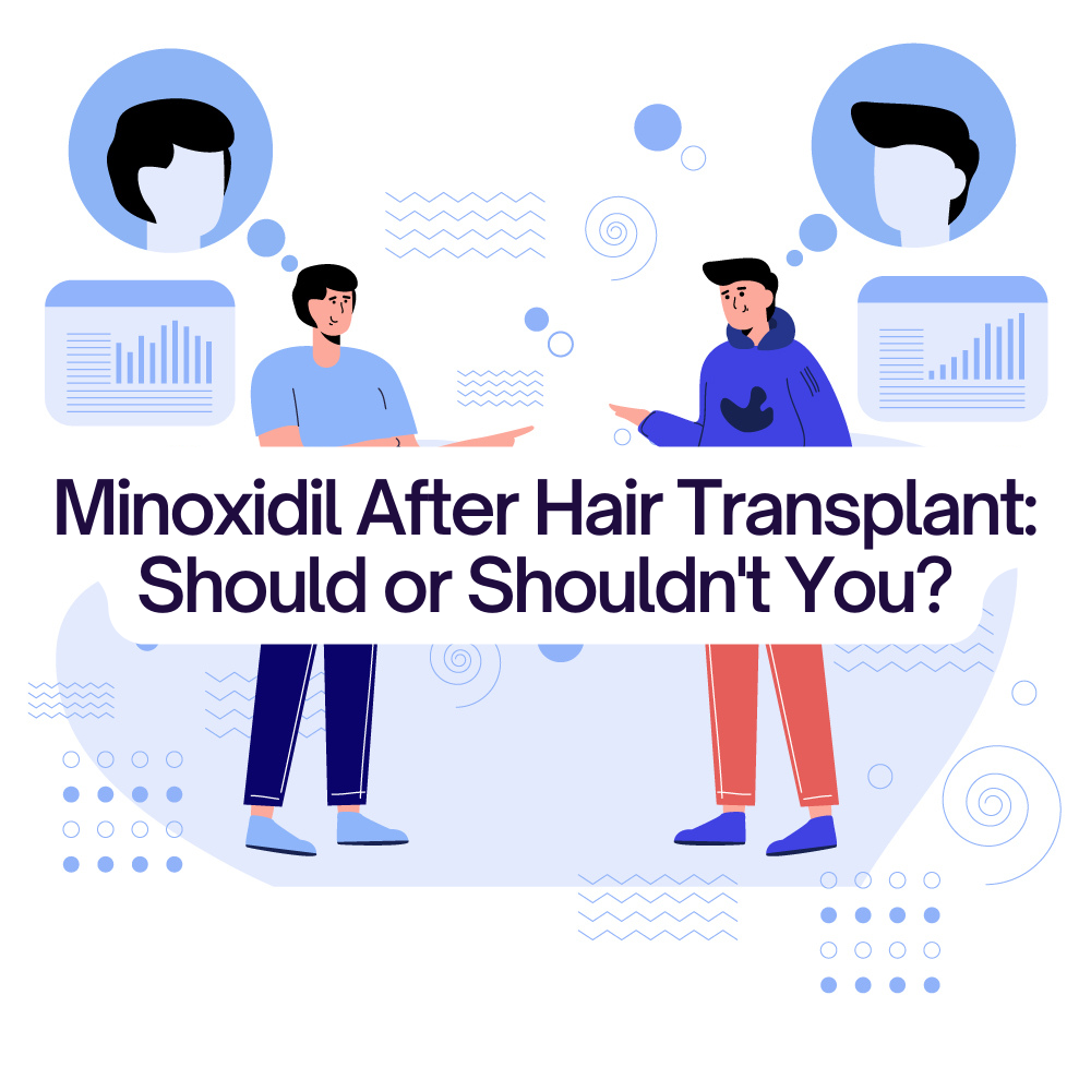 Minoxidil After Hair Transplant: Should or Shouldn't You?