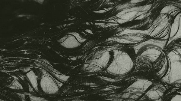 Why some experience shedding