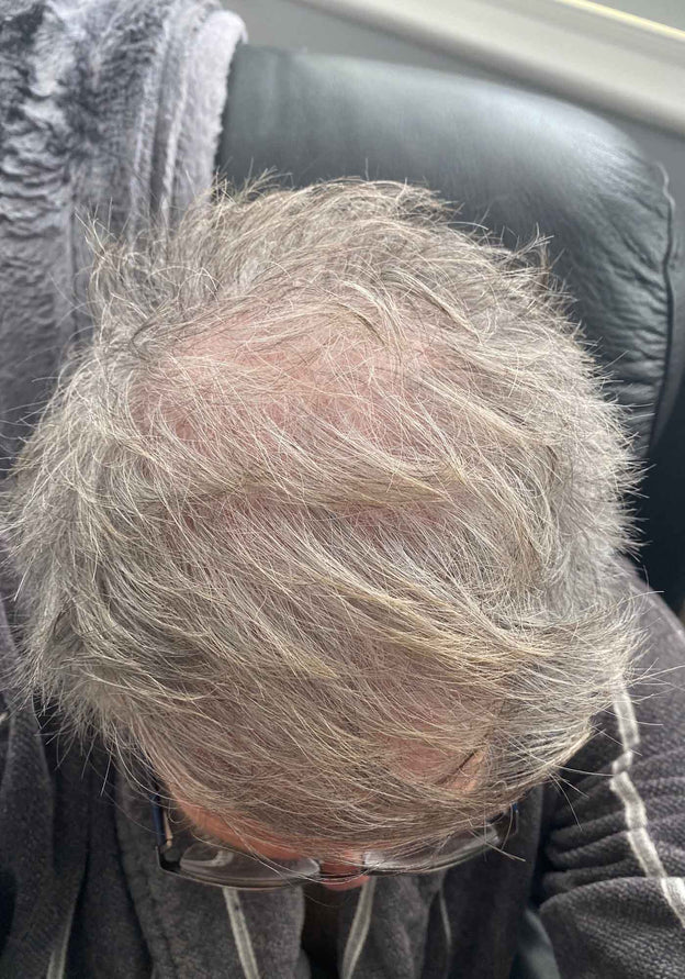After - Gary