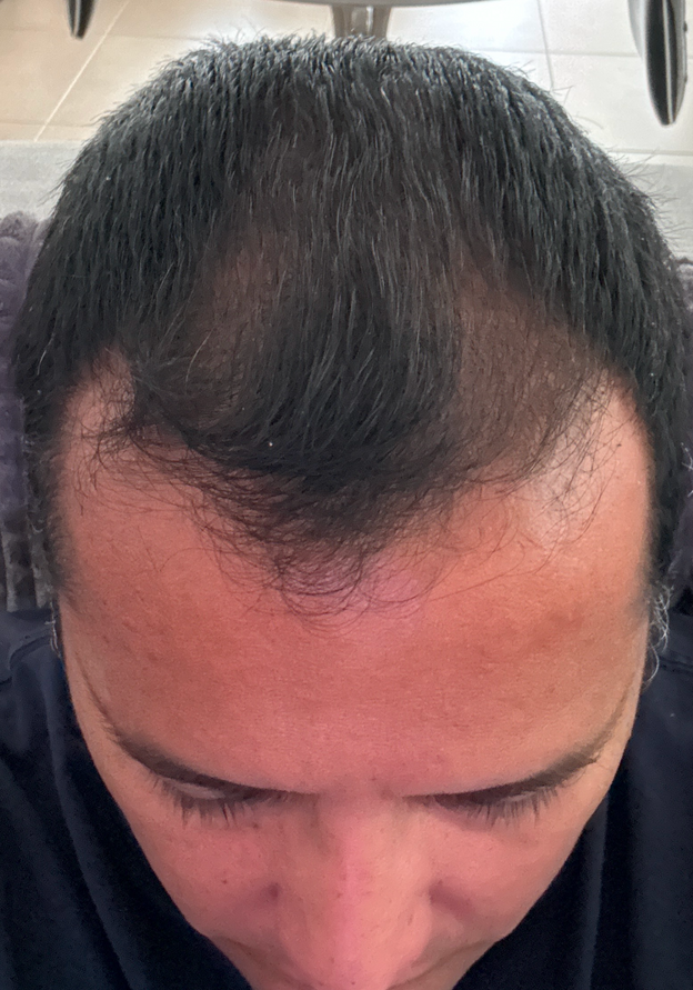 After - Giancarlo